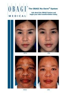 Obagi-Skin-Care post pic 4